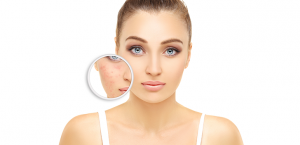 Magnification of a woman's blemishes