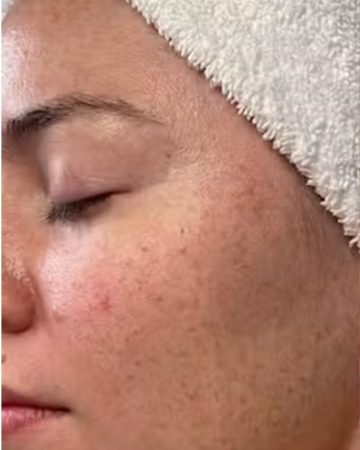 DiamondTome Facial