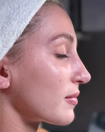DiamondTome microdermabrasion facial treatment