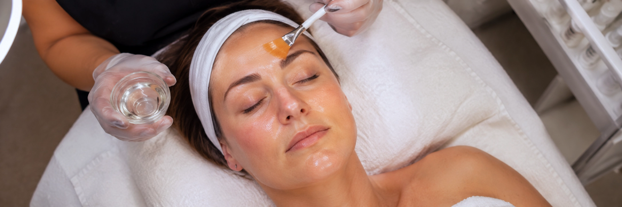 What a Chemical Peel Actually Does and Whether It’s Right for You
