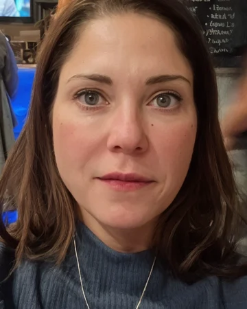 Platelet rich plasma treatment for eyes